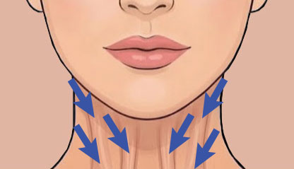 Illustration showing Neck, Botox Neck Bands treatment areas